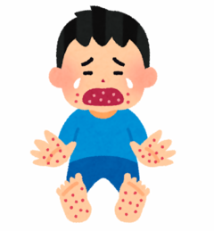 手足口病